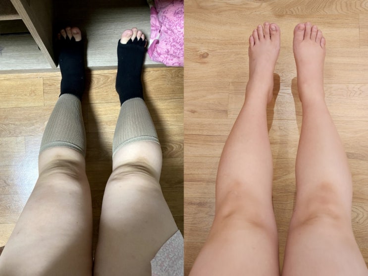 [후기] 신여성부설 레디산후조리원 / 산후마사지 Before & After / 14.5kg 감량 / 내돈내산 찐후기