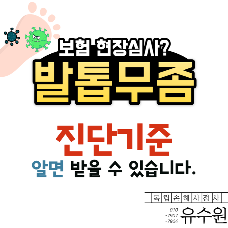  KOH검사, 무좀 레이저 치료 시 보험금 받기 위한 조건