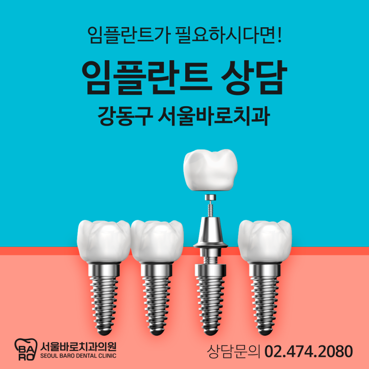  임플란트가 필요하시다면, 강동구 성내동치과에서 알려드립니다.