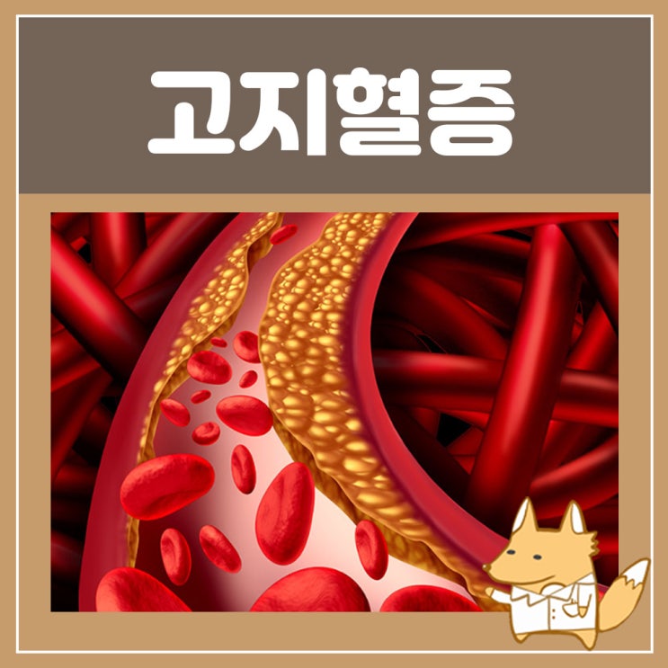  고지혈증약 종류 리피토정 크레스토 : 고지혈증 원인 수치