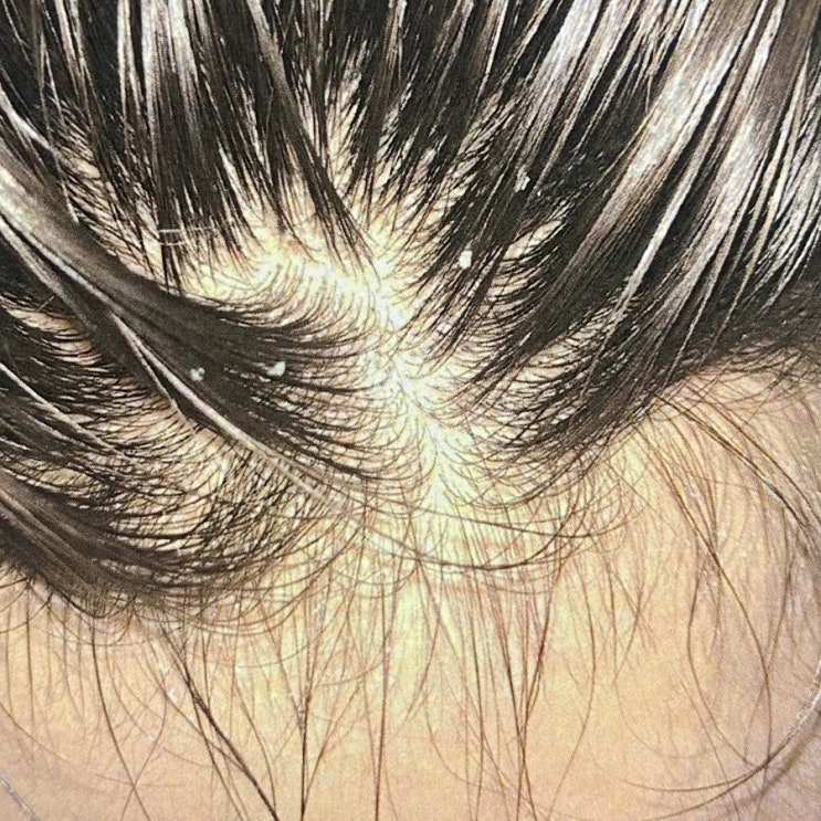  약산성샴푸 자극없이 순해요!
