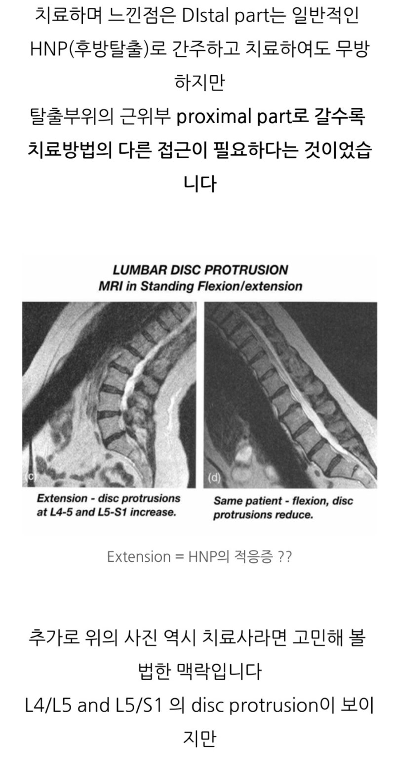 추간판탈출증(디스크) : 네이버 블로그