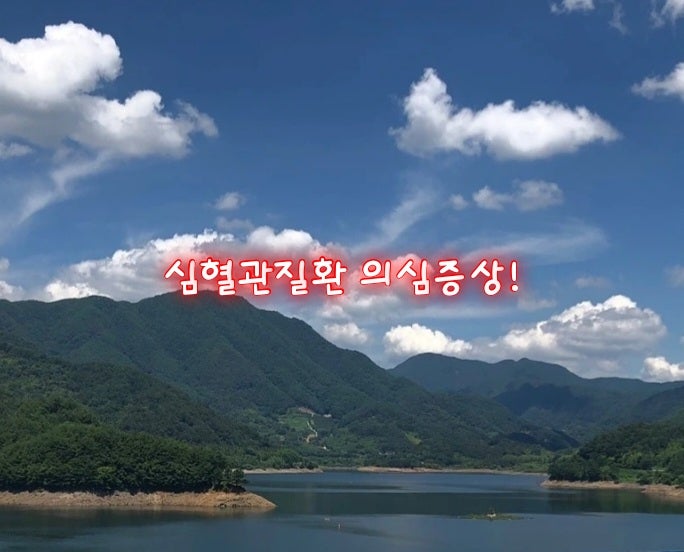 심혈관질환 의심증상! 심혈관질환 의심증상!