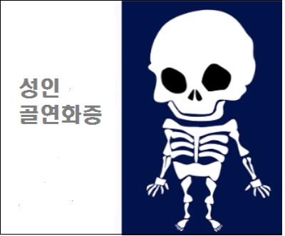  성인골연화증 증상 및 치료