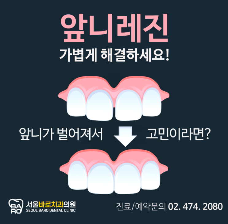  앞니가 벌어진 것 같다고요? 걱정 마세요~ 성내동 치과에 치료방법이 있습니다.