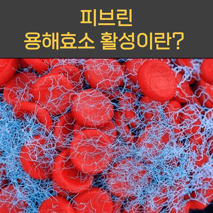  피브린 용해 효소활성 이란?