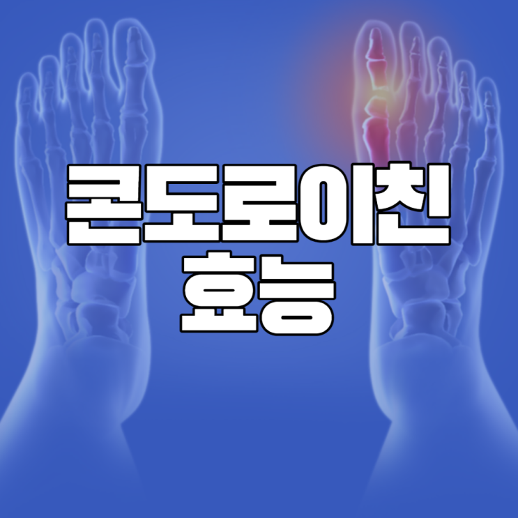 콘도로이친 효능 알아보고 콘드로이친 부작용 주의하여 관절건강 지키세요 콘도로이친 효능 알아보고 콘드로이친 부작용 주의하여 관절건강 지키세요