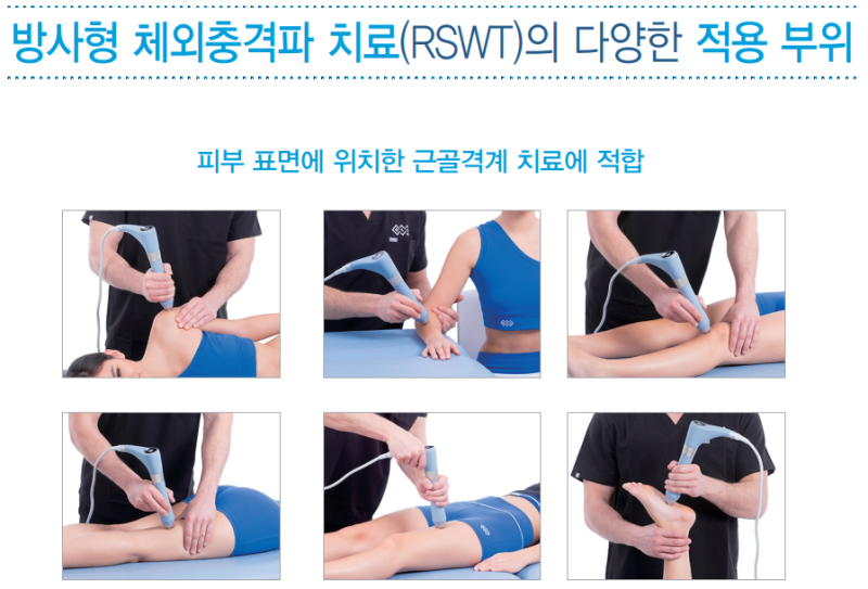 BTL 체외충격파 치료기 (ESWT) 