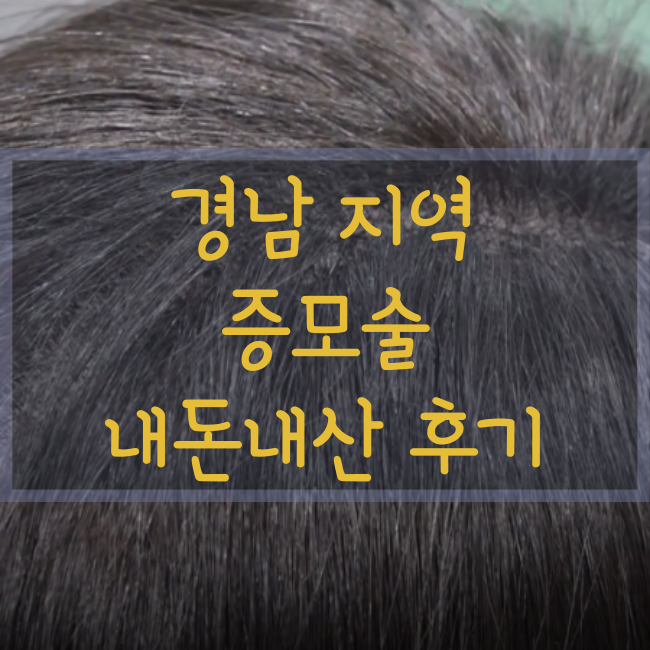  [내돈내산]부산/거제 탈모, 결혼식 때 가발 대신 증모술