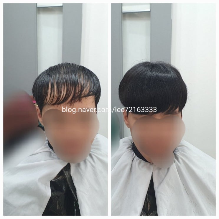  보톡스증모술로 3만모의 답을 가발덕후 은주누나와 함께해요~
