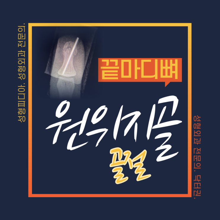 [수부] 끝마디뼈 골절, 원위지골 골절, 조갑하혈종 (feat, 광선 고정술)