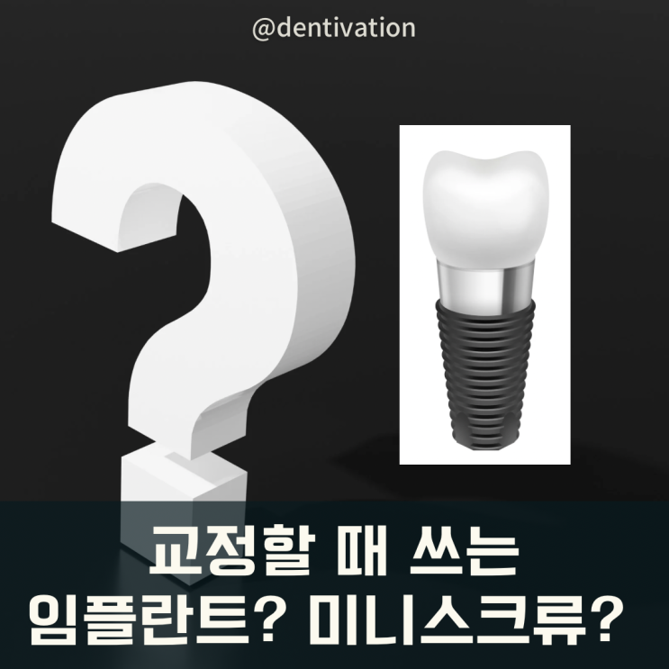  교정할 때 쓰는 임플란트? 교정용 미니스크류, 미니임플란트, 교정나사, TADs (miniscrew, mini-implant)