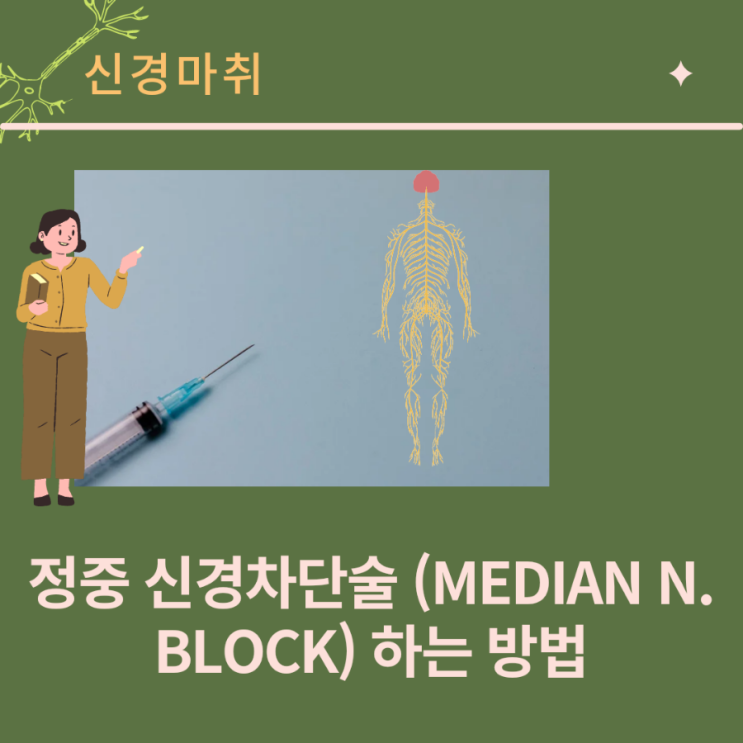 정중 신경 차단술 (median nerve block) 하는 방법과 주의사항, 부작용까지.