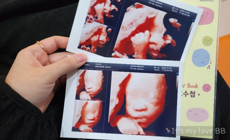 [김해/내외동] 우리여성병원 임신8개월 자궁수축 4D입체초음파2차 29주2일 꼬몽이 보러 가는 날 :)