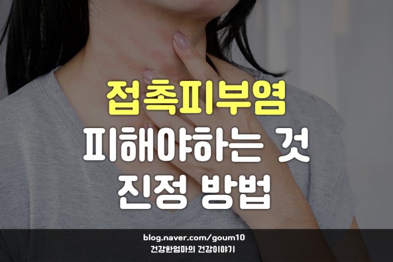 접촉성피부염 수포 발생 시 하면 안 되는 것 & 효과적인 진정 방법