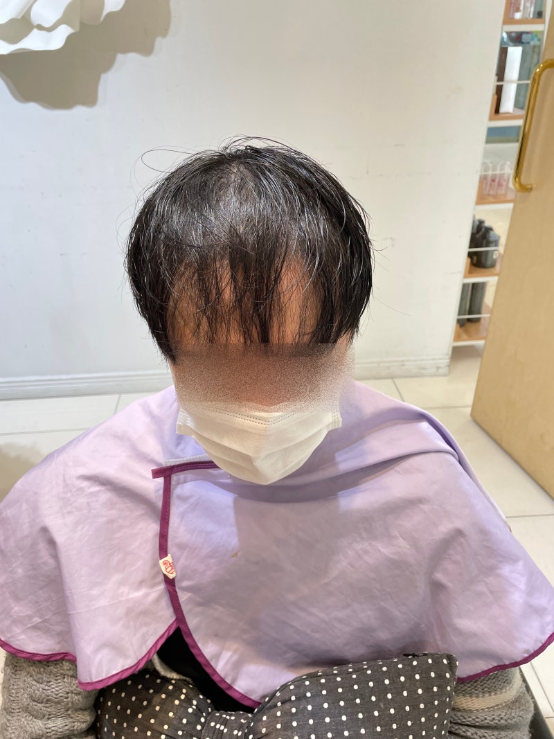 20대 숱없는 앞머리 남자 헤어증모술