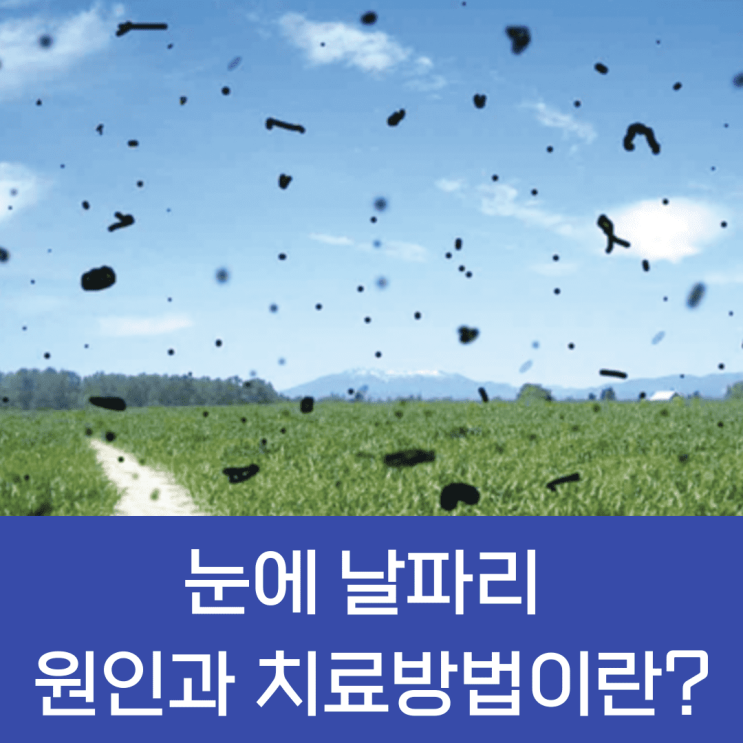 눈에 날파리 원인과 치료방법이란?