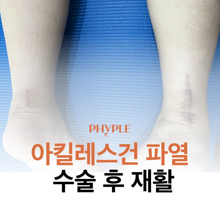 인천 아킬레스건 재활/아킬레스건 파열 수술 후 재활 인천 아킬레스건 재활/아킬레스건 파열 수술 후 재활