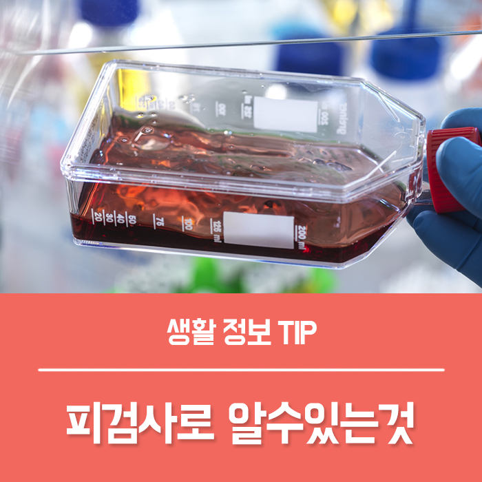  적혈구 RBC 수치, 헤모글로빈 HB 수치, 빈혈 수치 MCH WBC HCT MCHC MCV CRP 정상수치 피검사로 알수있는것