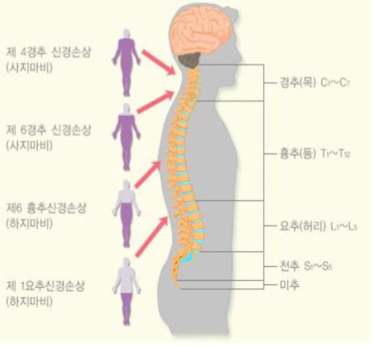  허리통증의 원인은 바로  `이것` 때문입니다.  (#신길운동전문가 #신길pt #신길동pt #신길뉴타운pt,#신길재활pt, #재활전문pt, #pt,#피티