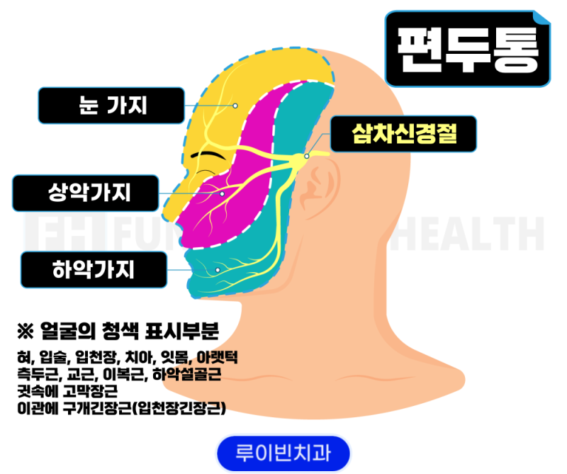 왼쪽 및 오른쪽 편두통: 알아야 할 사항