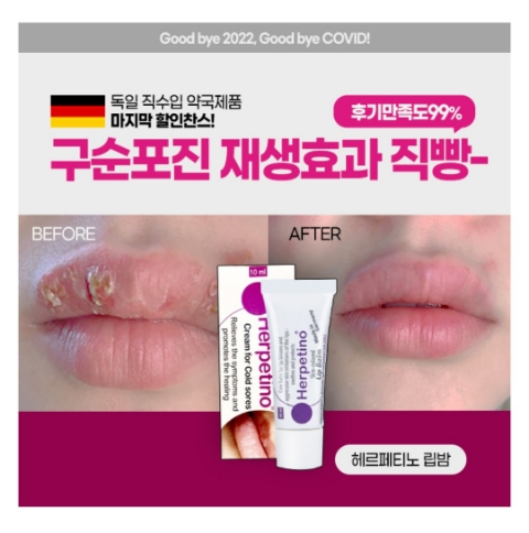  12월 24일 캐시워크 돈버는퀴즈 헤르페티노 립밤 정답