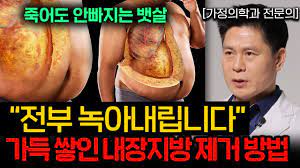 한달에 건강하게 5kg 빼는 '7가지' 원칙