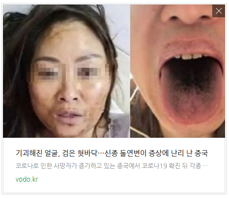 [오늘이슈] 기괴해진 얼굴, 검은 혓바닥…신종 돌연변이 증상에 난리 난 중국