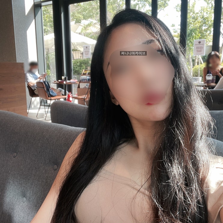  헤어라인수술 모발이식 2개월~5개월 후기 (내돈내산)