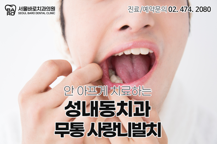  성내동치과에서 무통 사랑니 발치로 두려움을 해결해 드립니다.