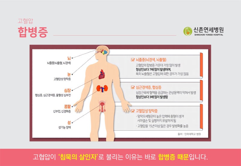 혈압을 낮추는 방법: 고혈압 합병증 혈압을 낮추는 좋은 음식