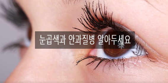  눈곱색과 안과질병 알아두세요