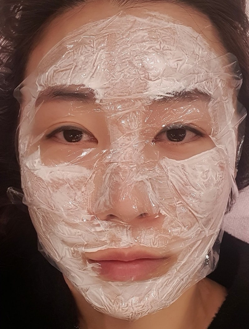 피지 증식증(과형성증) co2 레이저 2번째 후기 효과/ 이마 잔 주름 스킨 보톡스(메디톡스) 리뷰 : 네이버 블로그, image size:800x1054