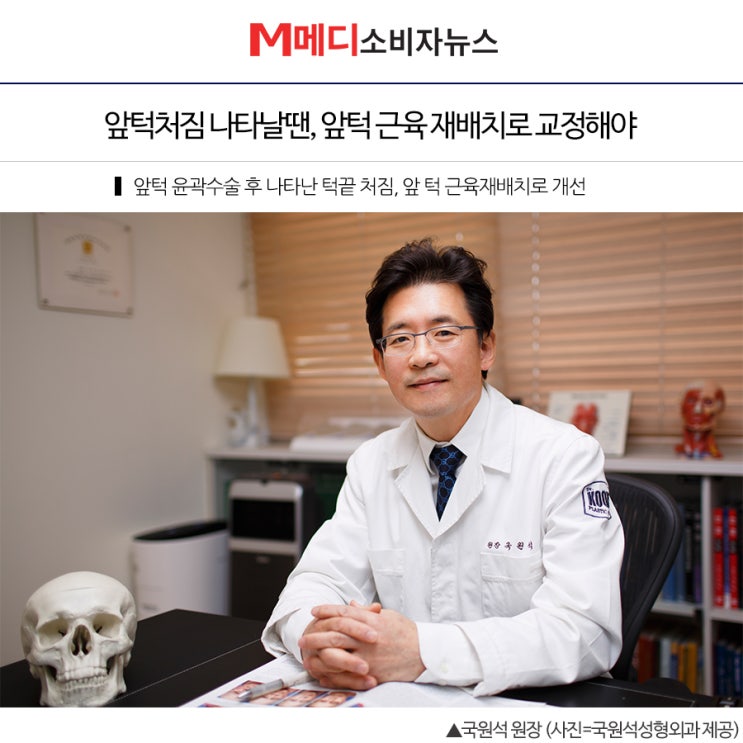  [앞턱처짐 언론보도] 앞턱처짐 나타날땐, 앞턱 근육 재배치로 교정해야