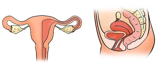 칸디다질염 원인과 치료방법