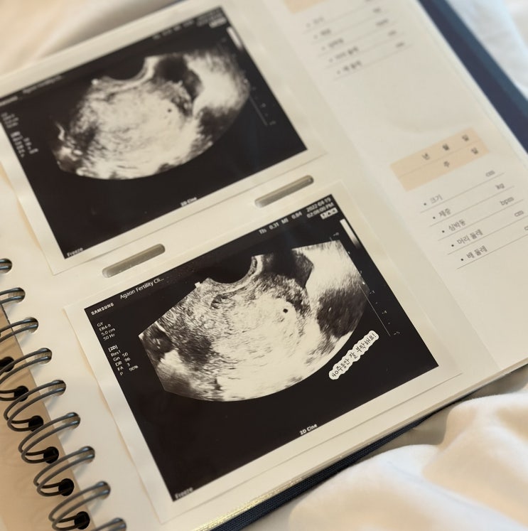  [임신초기/ ~12주차] 임신초기증상, 임밍아웃, 임신확인서 발급, 임산부혜택, 임신바우처, 임신어플 추천