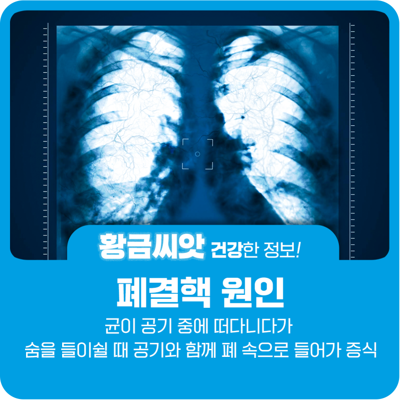 폐결핵 증상 전염 원인 잠복결핵 치료 : 네이버 블로그