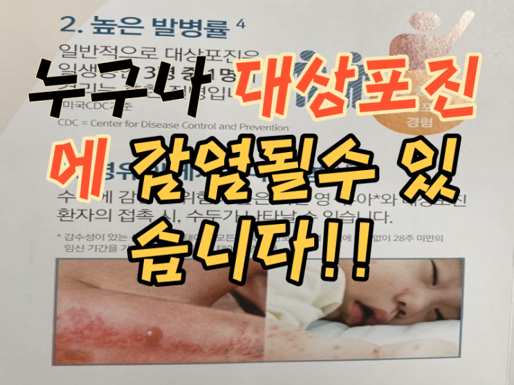  대상포진 초기증상 예방법 치료방법예방접종 안면대상포진 수액주사