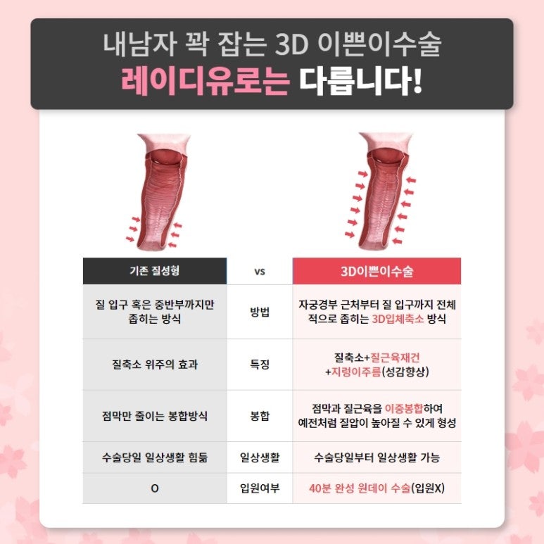 예쁜여자수술을 자세히 비교해보면,