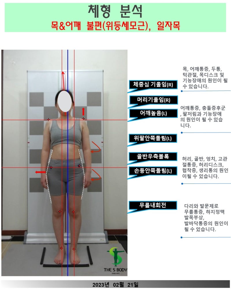 불당동 일자넥 사무직 골반비대칭 손목통증 어깨무게 승모근결림 발목접기