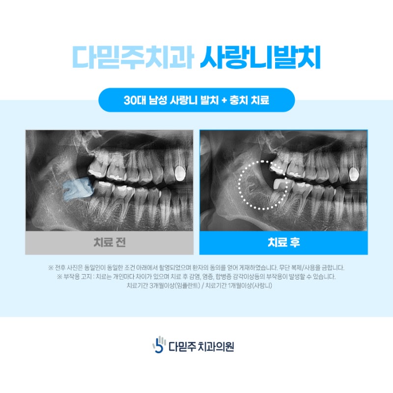 부산 세 마이온 치과 진료소를 치료하는 방법을 알아보십시오