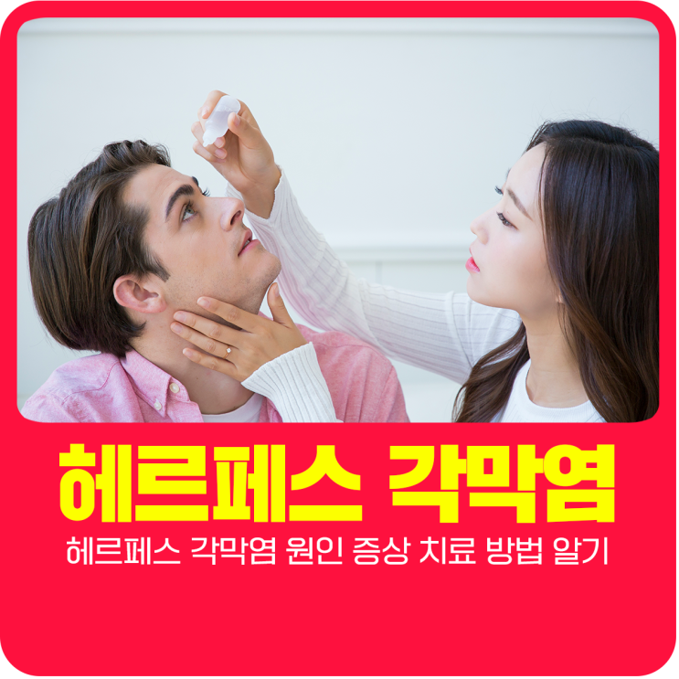  헤르페스 각막염 원인 증상 치료 방법 알기