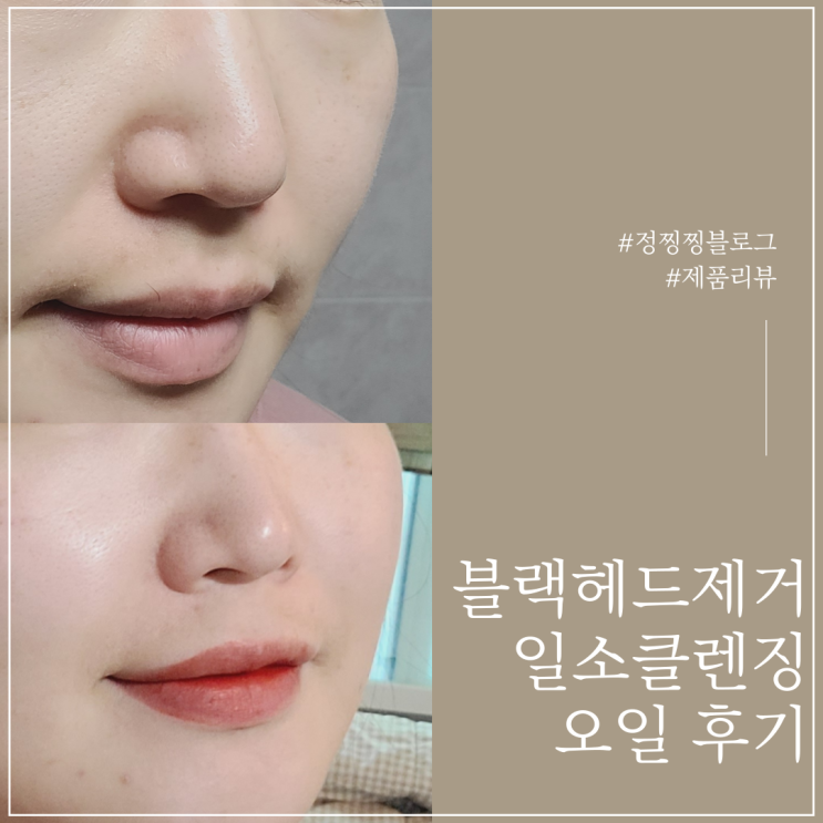  코 블랙헤드제거 도전 일소 클렌징오일 후기