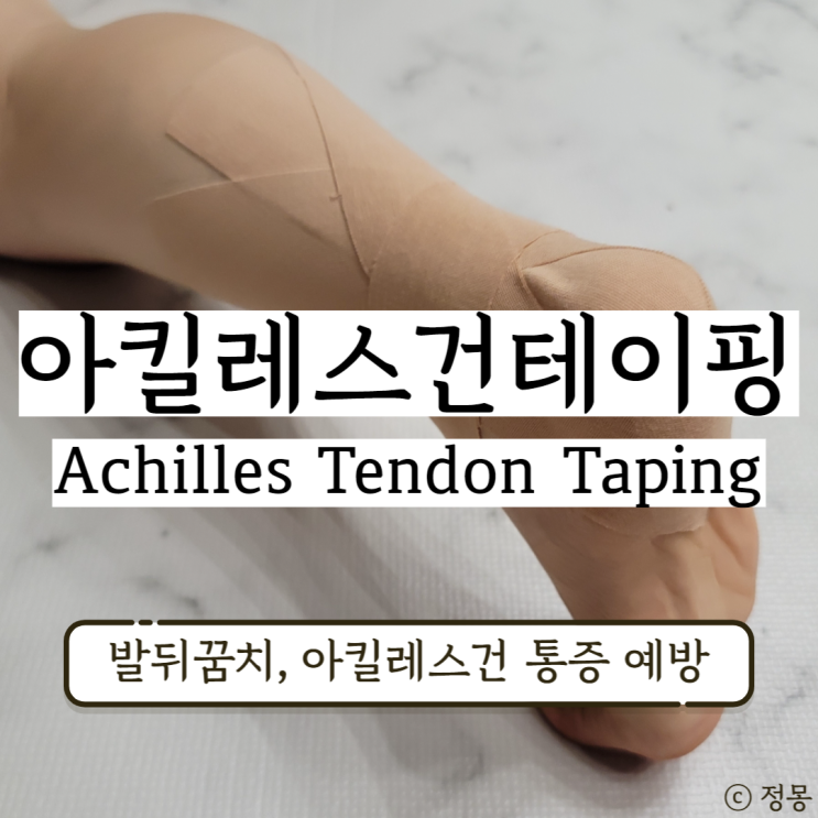 아킬레스건 테이핑 발목 테이핑방법 발뒤꿈치 통증 아킬레스건염 아킬레스건 테이핑 발목 테이핑방법 발뒤꿈치 통증 아킬레스건염