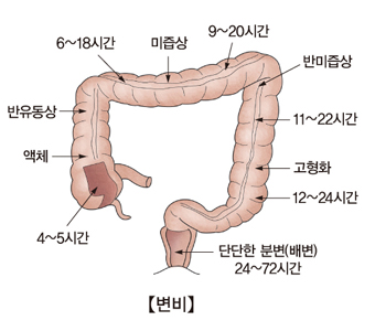  변비 치료에 나쁜 좋은 음식