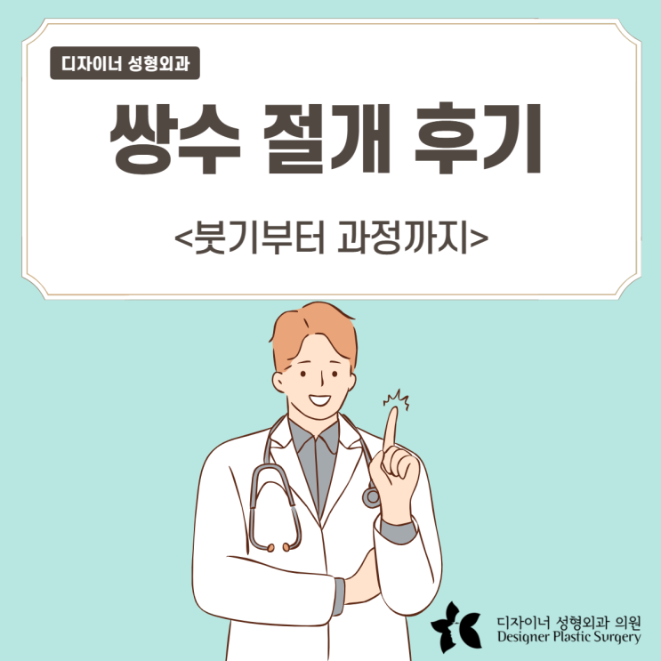  쌍수 절개 후기 붓기부터 과정까지 (1개월차)