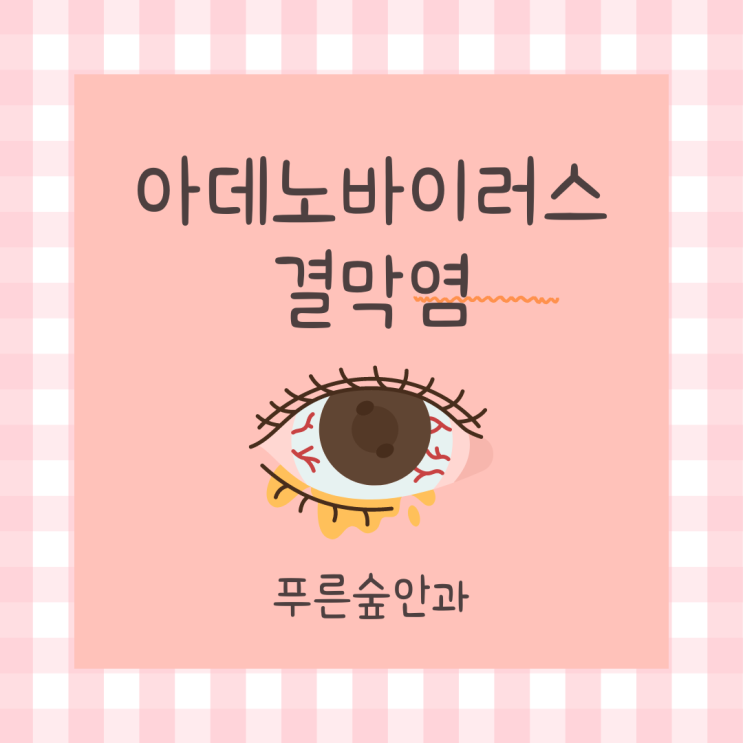  감기 후 충혈되고 눈곱끼는 결막염 - 아데노바이러스 결막염?