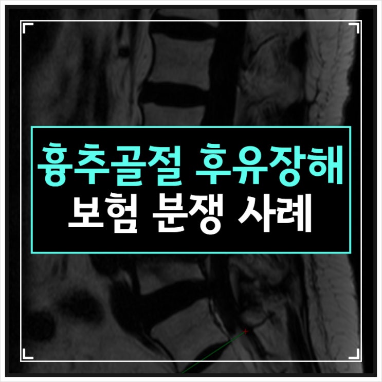 흉추골절 후유장해 보험 분쟁 사례