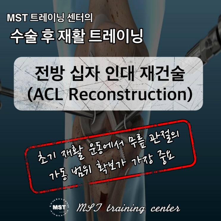  전방십자인대 재건술 재활 프로그램 - 관절 가동 범위 확보