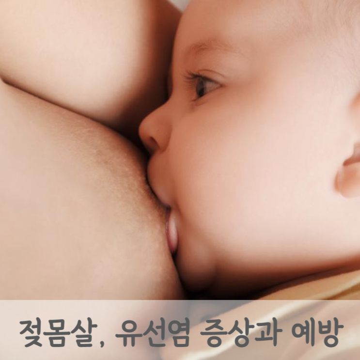 출산 후 모유수유 가슴통증, 유선염 젖몸살 증상과 예방 방법